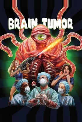 Brain Tumor